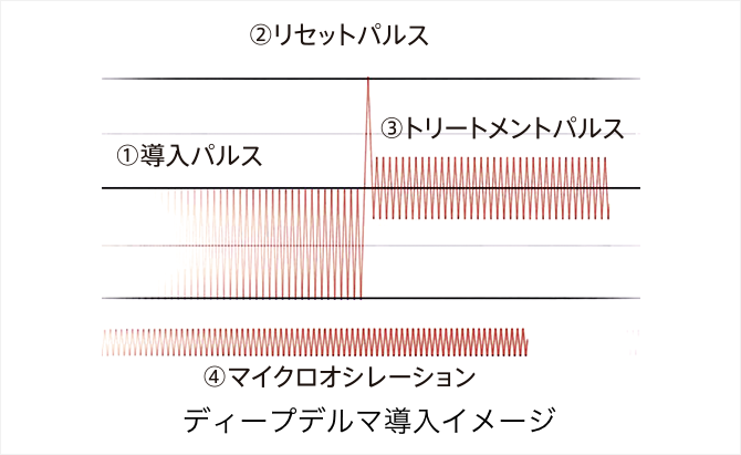 ディープデルマ説明図