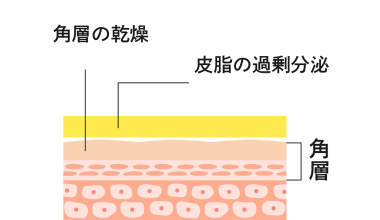角層