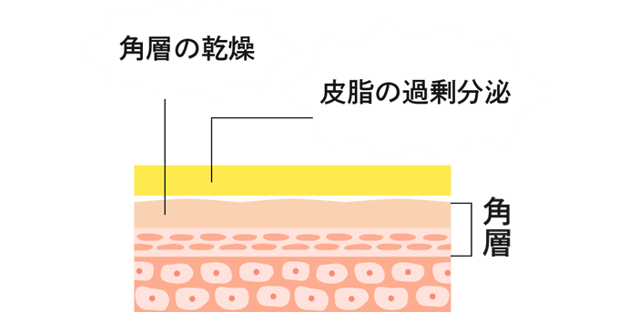 角層